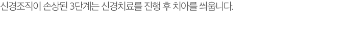 신경조직이 손상된 3단계는 신경치료를 진행 후 치아를 씌웁니다.